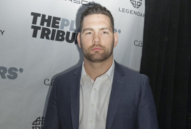 Chris Weidman Shares Gnarly X-Ray, Details Leg Injury (PHOTO)